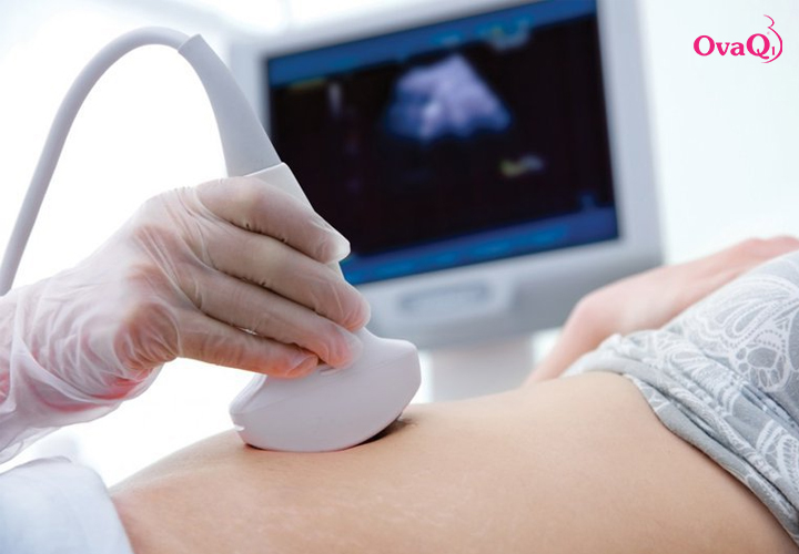 Siêu âm là một trong những cách xác định tuổi thai IVF chuẩn xác